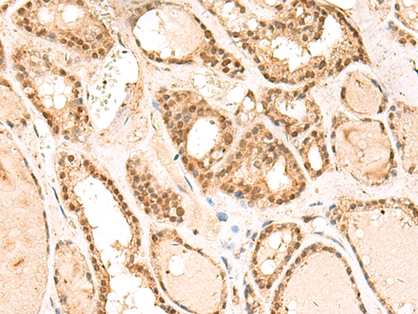 Anti-RPL13A Rabbit Polyclonal Antibody