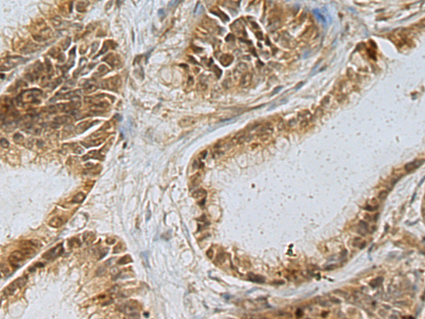 Anti-RPL13 Rabbit Polyclonal Antibody