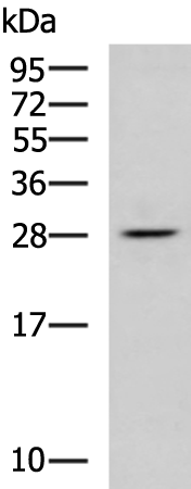 Anti-RPL13 Rabbit Polyclonal Antibody