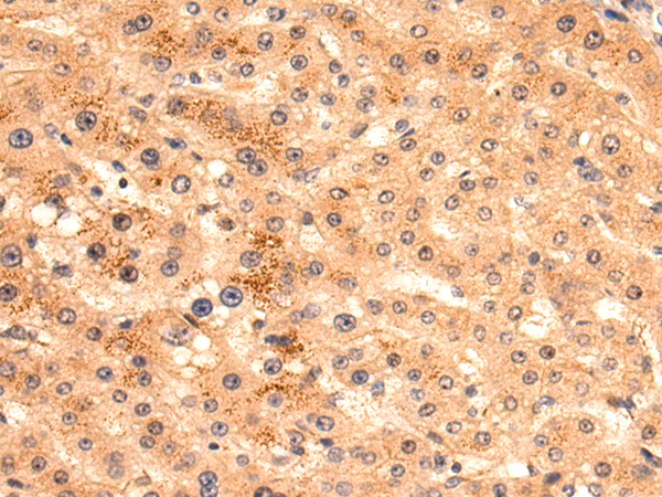Anti-HS1BP3 Rabbit Polyclonal Antibody