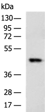 Anti-HS1BP3 Rabbit Polyclonal Antibody