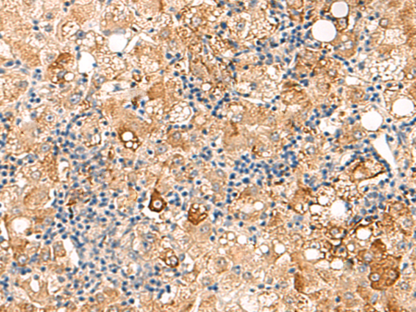 Anti-SEC22B Rabbit Polyclonal Antibody