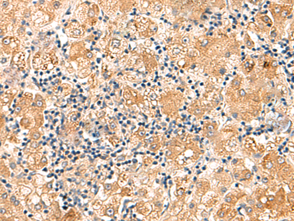 Anti-eIF3K Rabbit Polyclonal Antibody