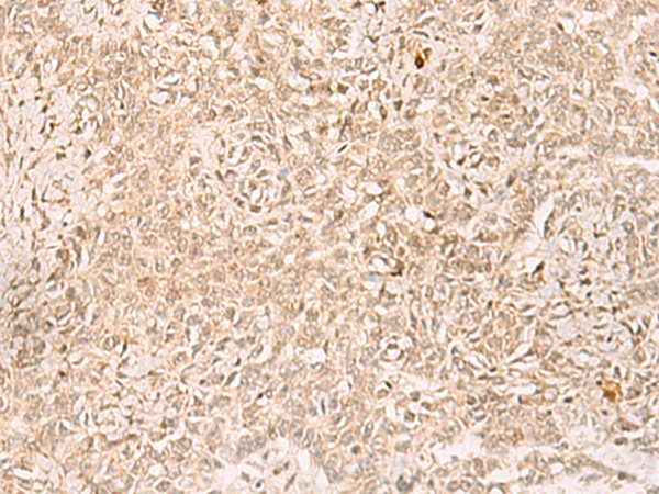 Anti-POP4 Rabbit Polyclonal Antibody