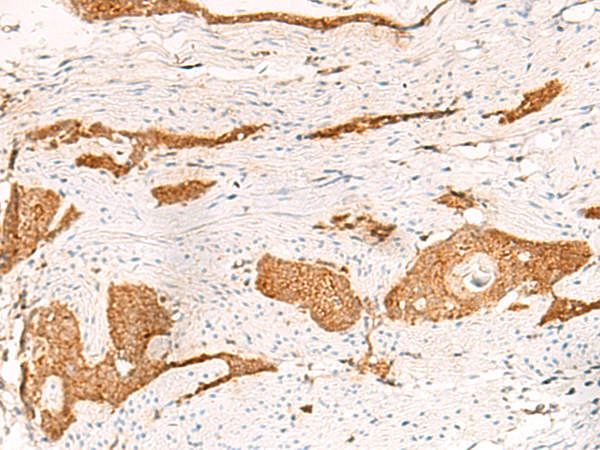 Anti-THNSL1 Rabbit Polyclonal Antibody