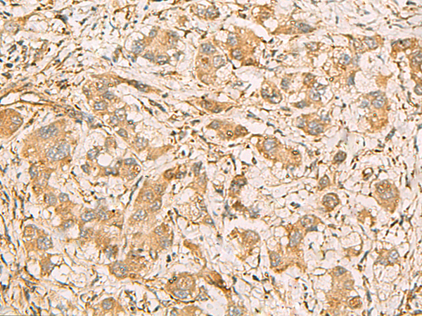 Anti-MRPS35 Rabbit Polyclonal Antibody