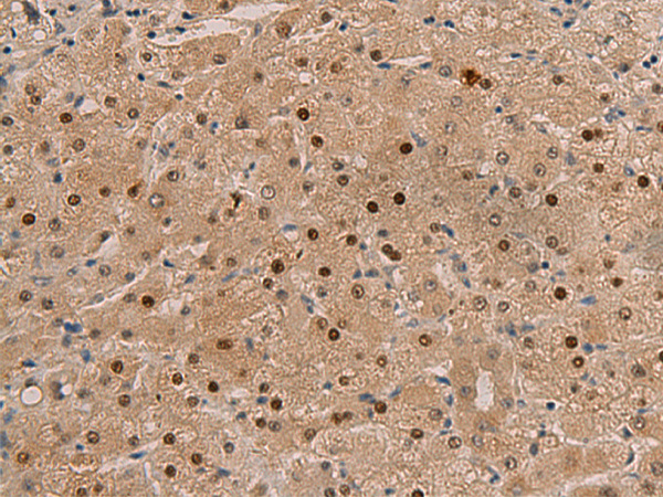 Anti-NAA10 Rabbit Polyclonal Antibody