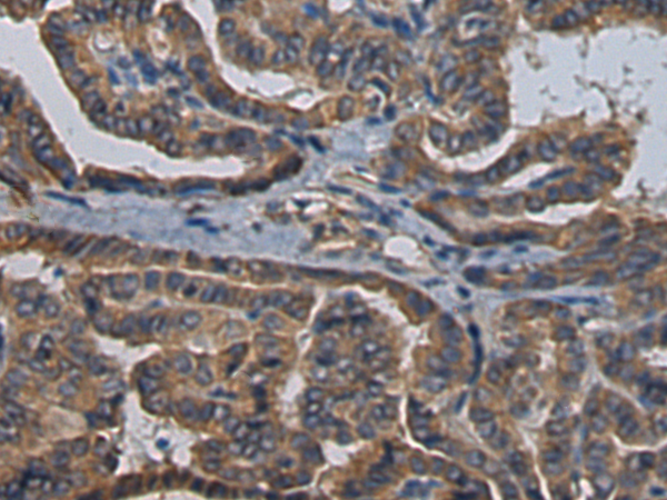 Anti-KCNIP4 Rabbit Polyclonal Antibody