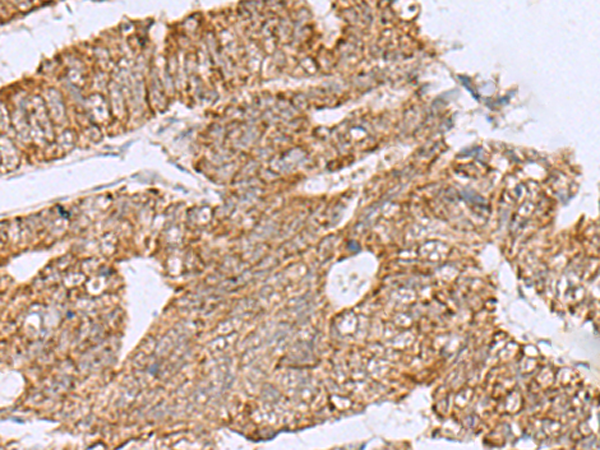 Anti-HCCS Rabbit Polyclonal Antibody
