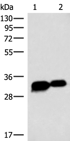 Anti-HCCS Rabbit Polyclonal Antibody
