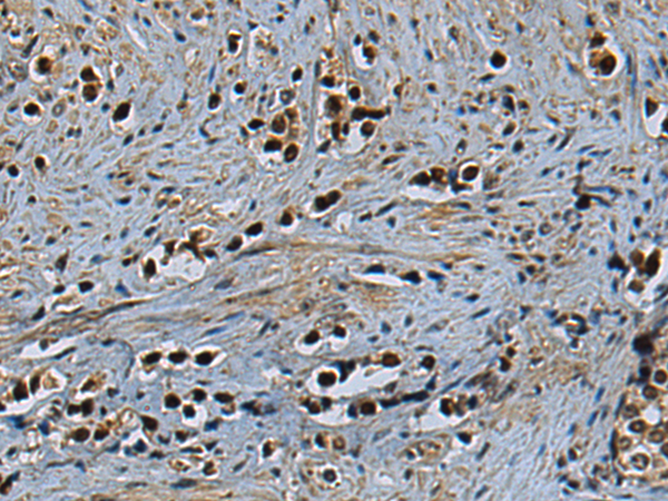 Anti-ZNF688 Rabbit Polyclonal Antibody
