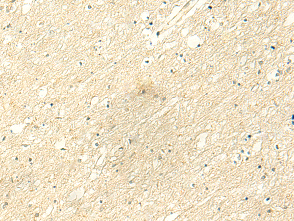 Anti-RNA Polymerase III Subunit C6 Rabbit Polyclonal Antibody