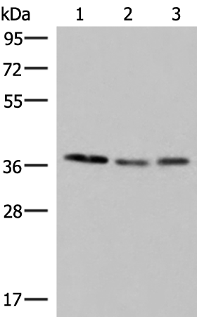 Anti-RNA Polymerase III Subunit C6 Rabbit Polyclonal Antibody