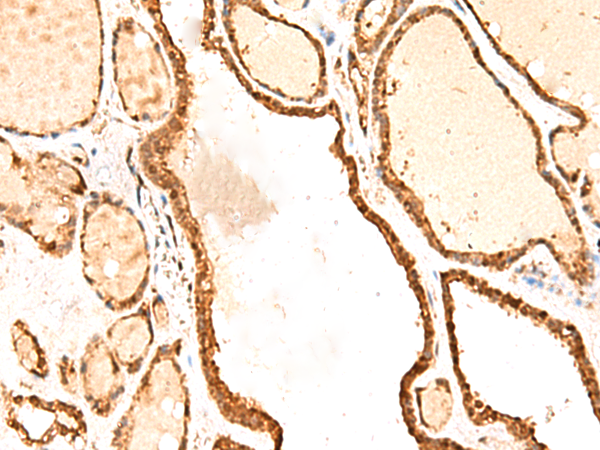 Anti-RETREG1 Rabbit Polyclonal Antibody