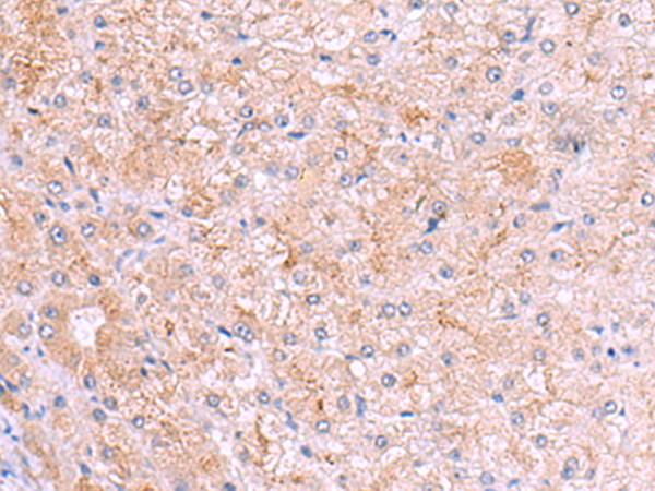 Anti-ASTE1 Rabbit Polyclonal Antibody