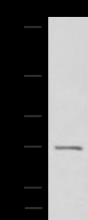 Anti-ASTE1 Rabbit Polyclonal Antibody