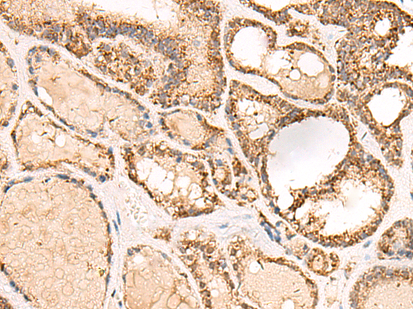 Anti-ECH1 Rabbit Polyclonal Antibody