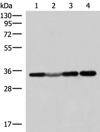 Anti-ECH1 Rabbit Polyclonal Antibody