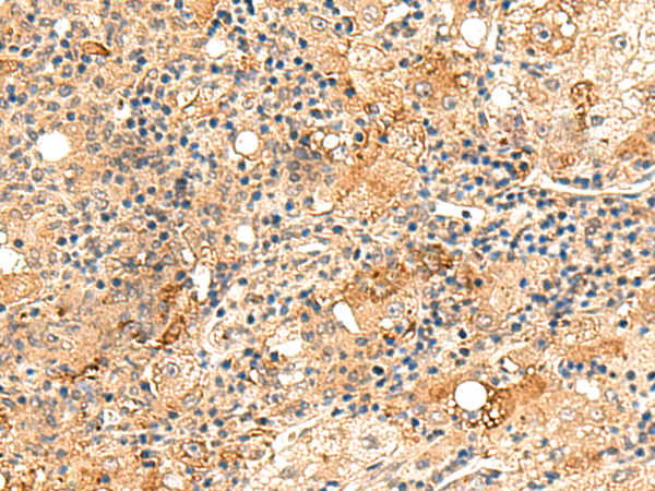 Anti-REG1B Rabbit Polyclonal Antibody