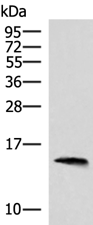 Anti-REG1B Rabbit Polyclonal Antibody