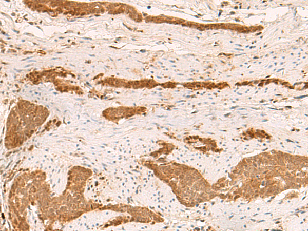 Anti-ZFYVE27 Rabbit Polyclonal Antibody
