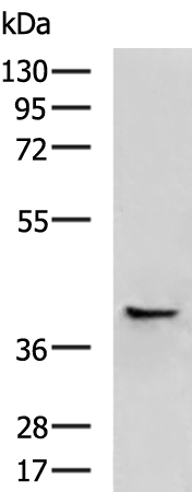 Anti-HLA E Rabbit Polyclonal Antibody