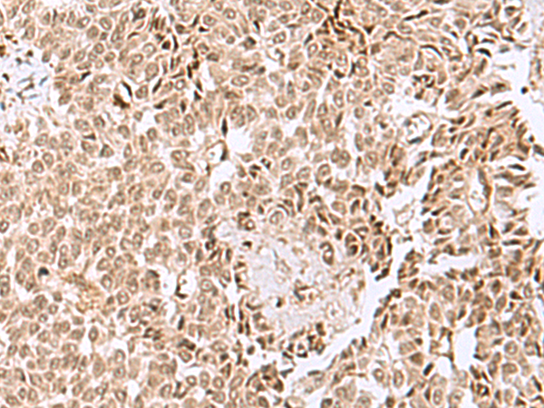 Anti-ELAC1 Rabbit Polyclonal Antibody