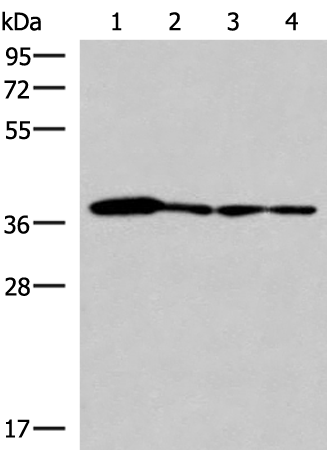 Anti-ELAC1 Rabbit Polyclonal Antibody