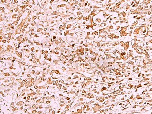 Anti-SAMSN1 Rabbit Polyclonal Antibody