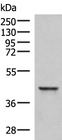 Anti-SAMSN1 Rabbit Polyclonal Antibody