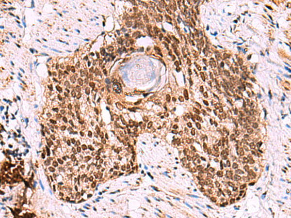 Anti-LDB1 Rabbit Polyclonal Antibody