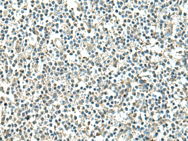 Anti-ATP6V1C1 Rabbit Polyclonal Antibody