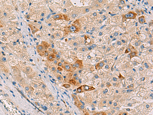 Anti-RMDN2 Rabbit Polyclonal Antibody
