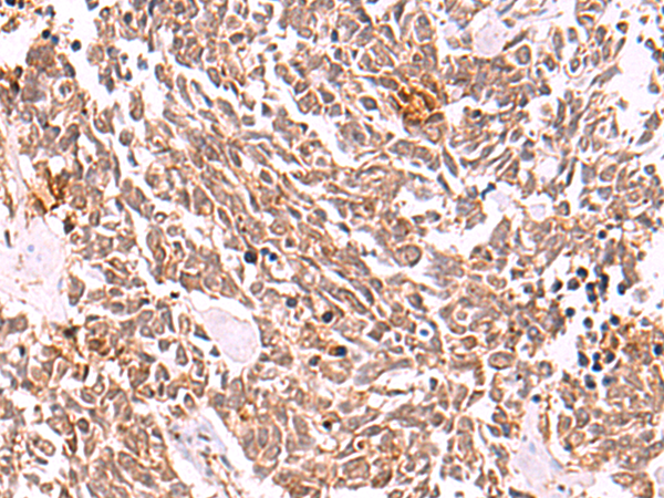 Anti-COPS3 Rabbit Polyclonal Antibody