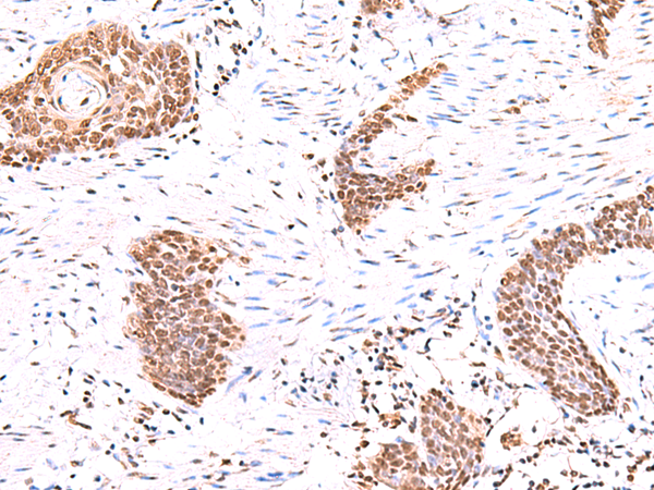 Anti-ACTL6B Rabbit Polyclonal Antibody