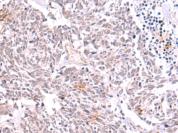 Anti-TRMT12 Rabbit Polyclonal Antibody