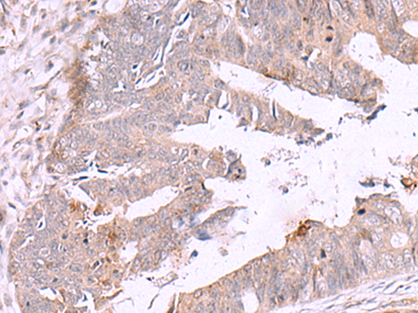Anti-ZSWIM1 Rabbit Polyclonal Antibody