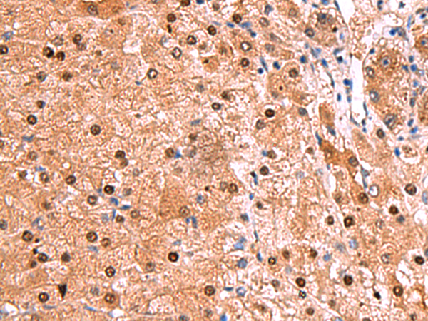 Anti-TSEN2 Rabbit Polyclonal Antibody