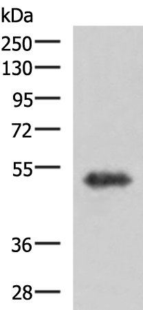 Anti-TSEN2 Rabbit Polyclonal Antibody