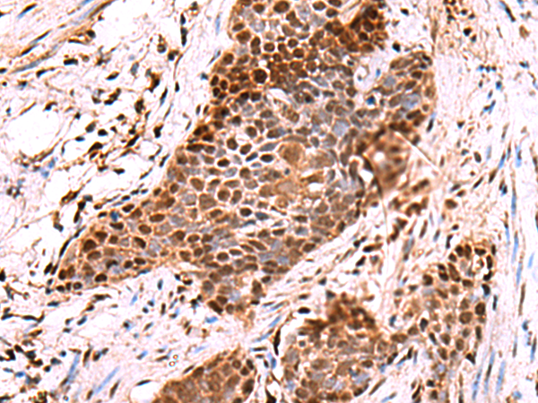 Anti-POLD2 Rabbit Polyclonal Antibody