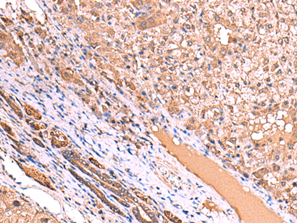 Anti-TPR Repeat Protein 38 Rabbit Polyclonal Antibody
