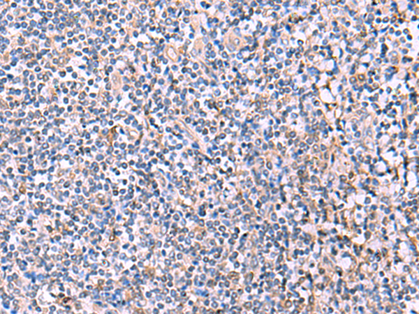 Anti-PEPD Rabbit Polyclonal Antibody
