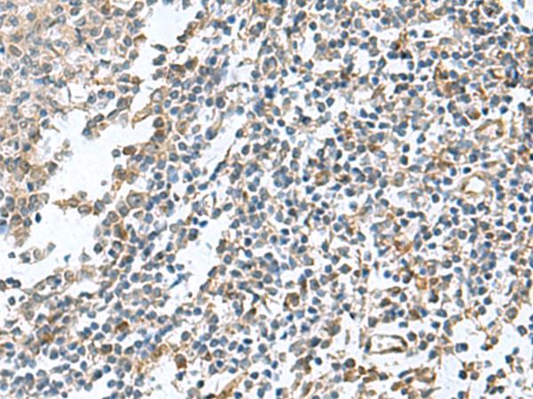 Anti-PAPSS2 Rabbit Polyclonal Antibody