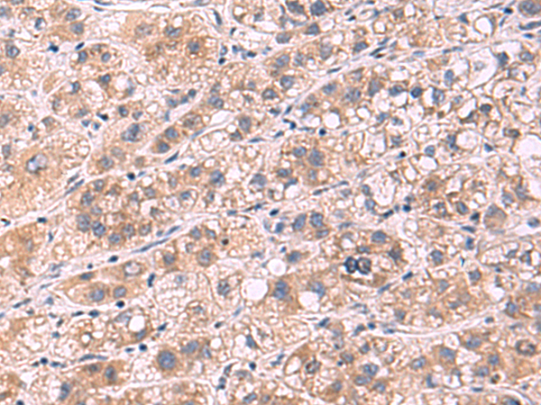Anti-PPEF1 Rabbit Polyclonal Antibody