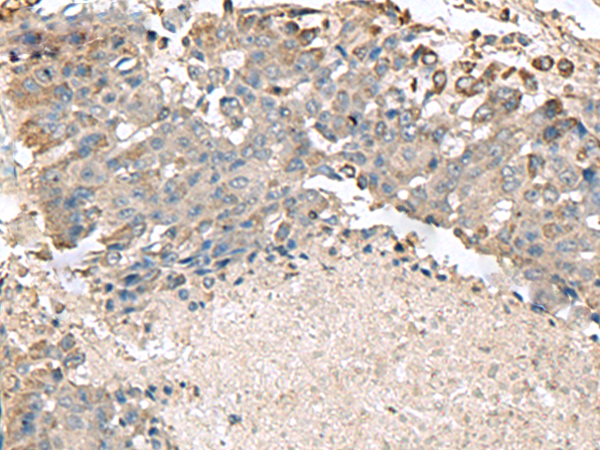 Anti-Transmembrane Protein 141 Rabbit Polyclonal Antibody