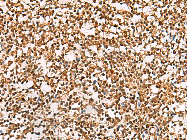 Anti-PHF5A Rabbit Polyclonal Antibody