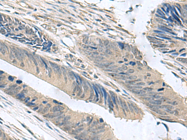 Anti-NPHP1 Rabbit Polyclonal Antibody
