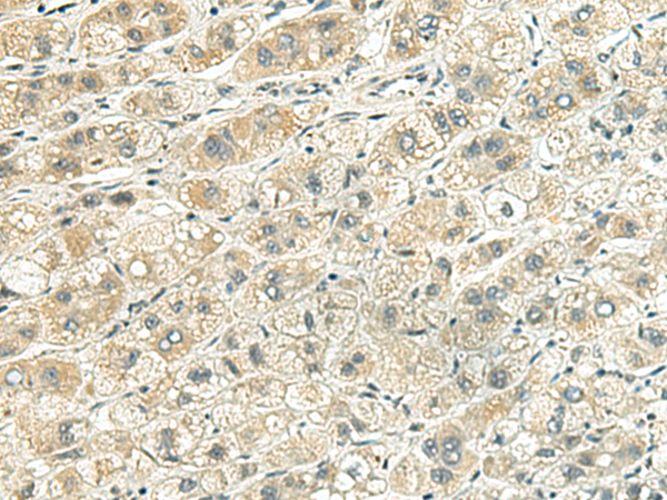 Anti-RRP2 Rabbit Polyclonal Antibody