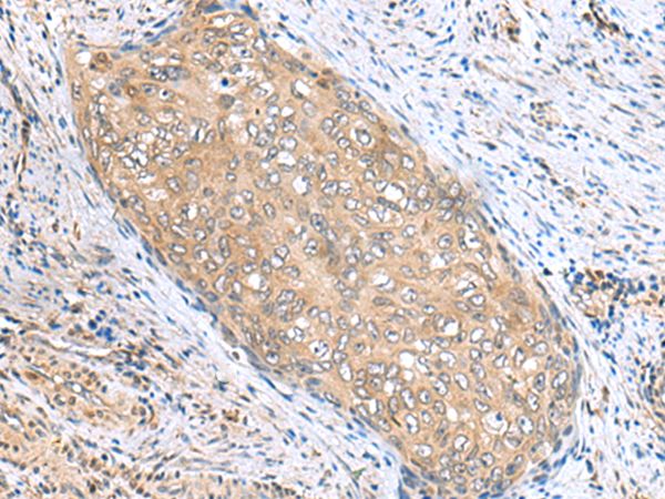 Anti-PHPT1 Rabbit Polyclonal Antibody