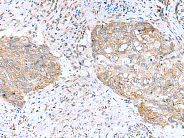 Anti-PAM16 Rabbit Polyclonal Antibody